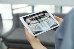 zahnärztin hält tablet in der Hand mit röntgenbild des mundes